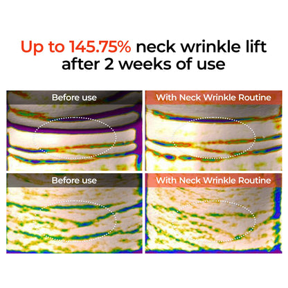 [Dr.Melaxin Exclusive] 3-Minute Neck & Face Anti-A