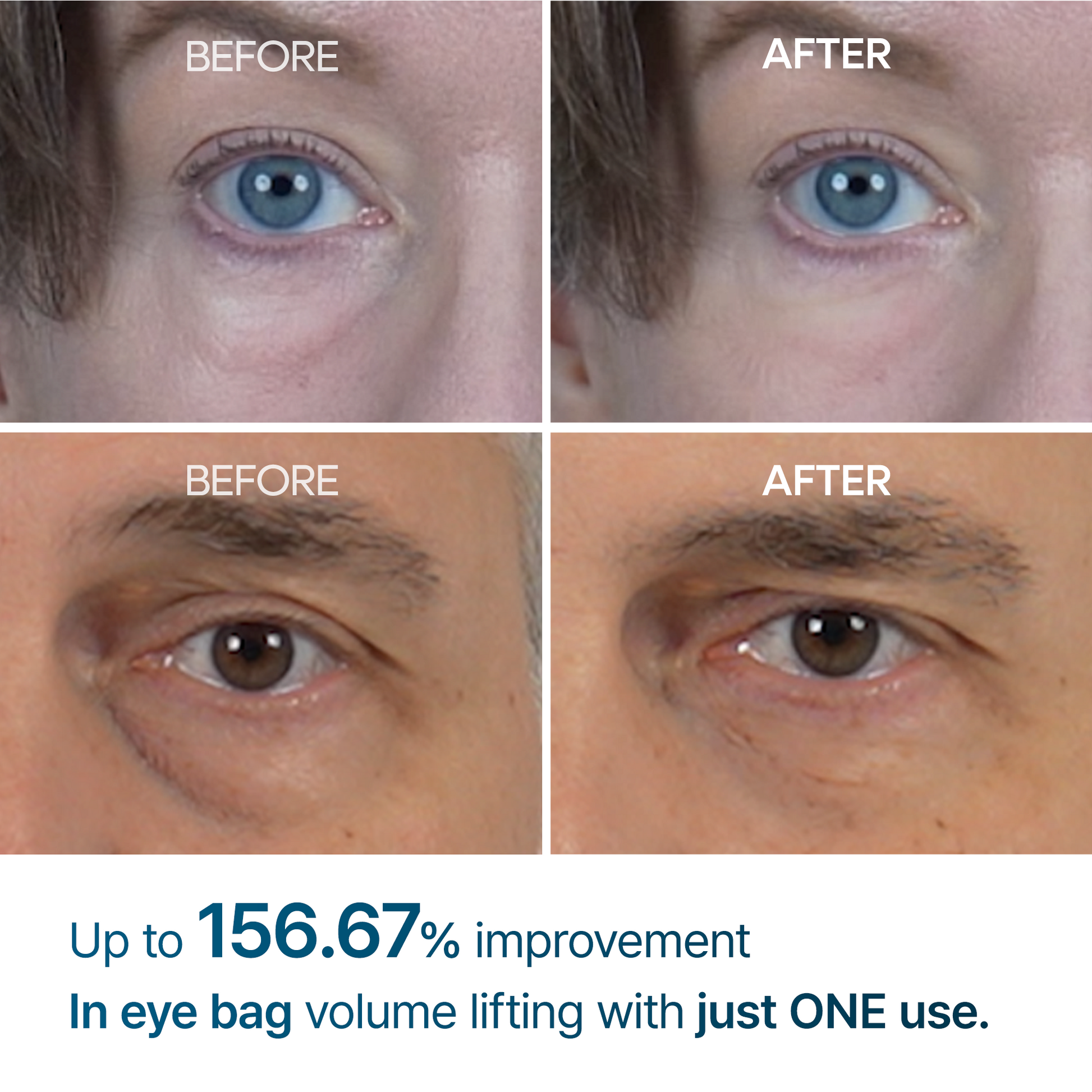 Eyephalt eyebag cream